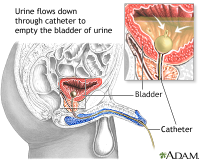 urine stick results