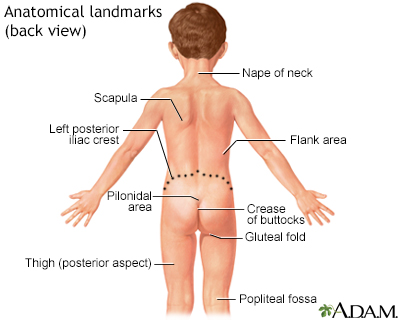 Dimples Above Buttocks