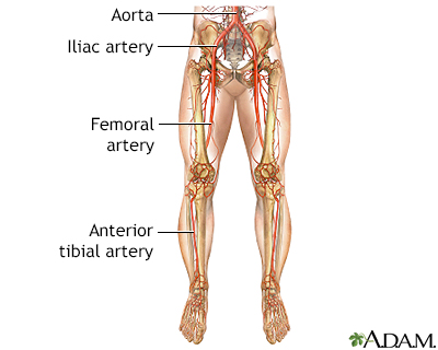 Hardening Of The Arteries Of The Legs