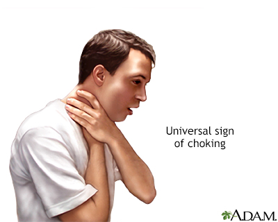 choking adult adam definition child year over someone universal when hard