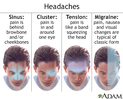 Headache aneurism facial pain