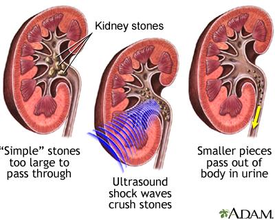 Body Kidney Location