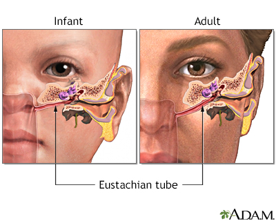 in infections adults Symptoms severe of ear