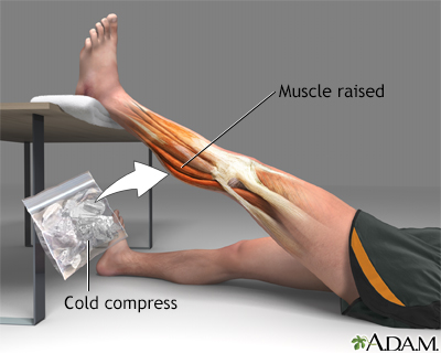 Muscle strain treatment