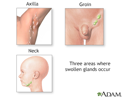 What are some common treatments for lymph node infections?