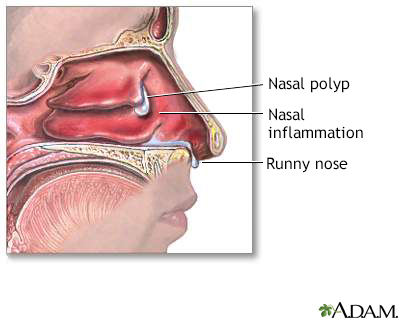 nasal definition