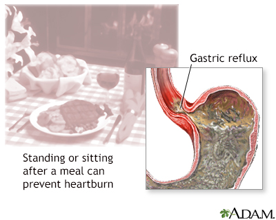 Is Increased Heartburn A Sign Of Labor